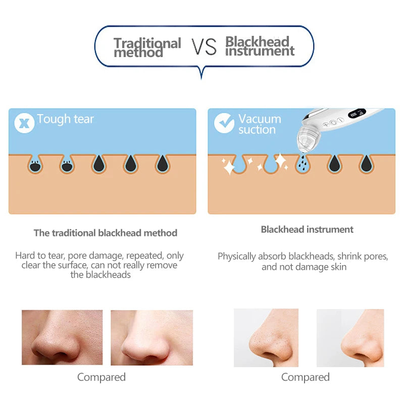 Electric Blackhead Remover Vacuum Acne Cleaner Facial Suction Deep Cleansing Pore Cleaner Machine Skin Care Tool
