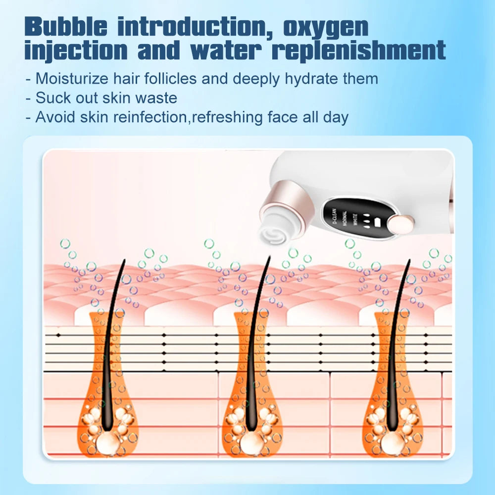 Electric Bubble Blackhead Remover Vacuum Suction Pore Cleaner Spot Acne Pimple Black Head Extractor Facial Cleaning Tools