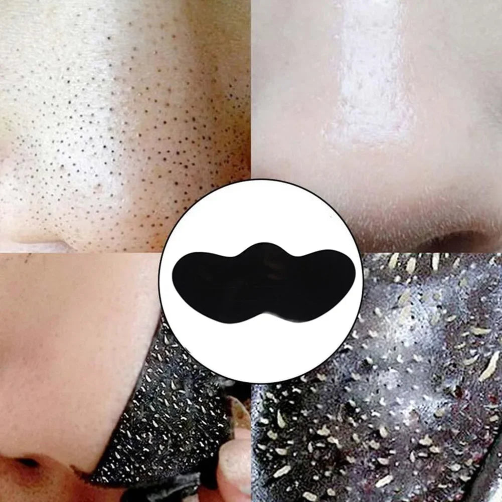 10PCS Nose Blackhead Remover Mask Deep Cleansing Skin Care Shrink Pore Acne Treatment Mask Nose Black Dots Pore Clean Strips