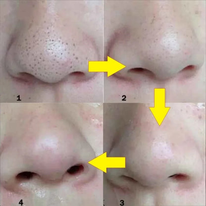 10PCS Nose Blackhead Remover Mask Deep Cleansing Skin Care Shrink Pore Acne Treatment Mask Nose Black Dots Pore Clean Strips