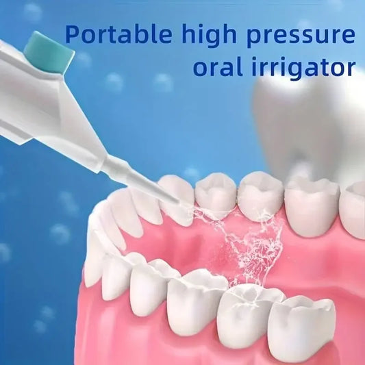 Portable Oral Irrigator – High Pressure Water Flosser