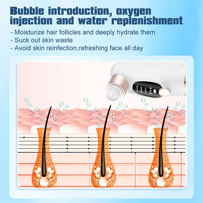 Electric Bubble Blackhead Remover Vacuum Suction Pore Cleaner Spot Acne Pimple Black Head Extractor Facial Cleaning Tools