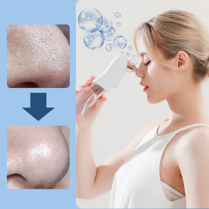 Electric Bubble Blackhead Remover Vacuum Suction Pore Cleaner Spot Acne Pimple Black Head Extractor Facial Cleaning Tools